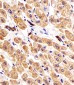 CYK18 Antibody (C-term)